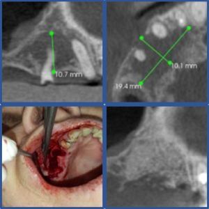 Esempio di intervento di rigenerativa 