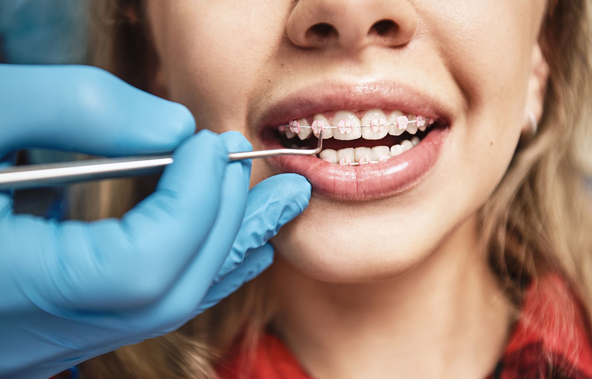 An orthodontist inspecting dental braces during a check-up. An orthodontist inspecting dental braces during a check-up.