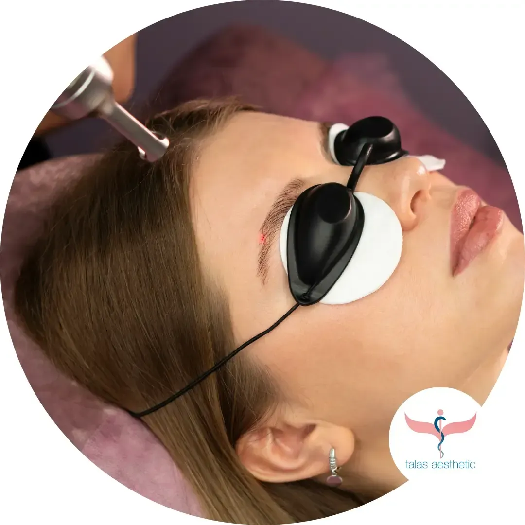 Entfernung von Microblading oder Permanent Make-up mit Laser bei talas aesthetic