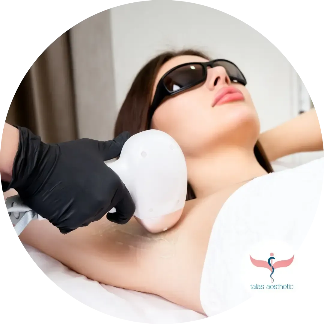 Laser-Haarentfernung bei talas aesthetic in Eppelheim – dauerhafte Haarentfernung