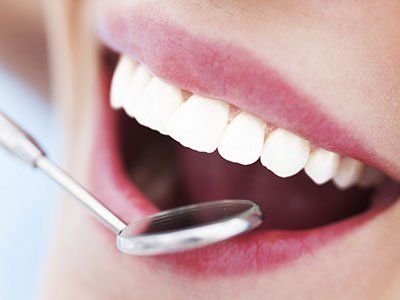 Tooth whitening - dental family, preventive, implants, dentures, oral surgery, teeth grinding, Annapolis Towne Centre Dental Care in Annapolis, US