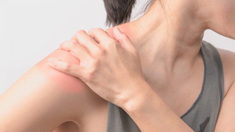 Frozen Shoulder