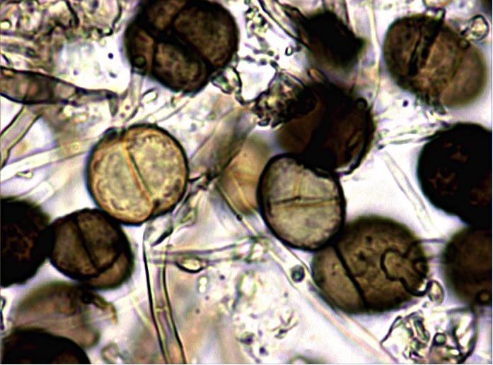 Microscopische opname van doorschijnende ronde deeltjes met donkerbruine kernen, verspreid over een lichte achtergrond.