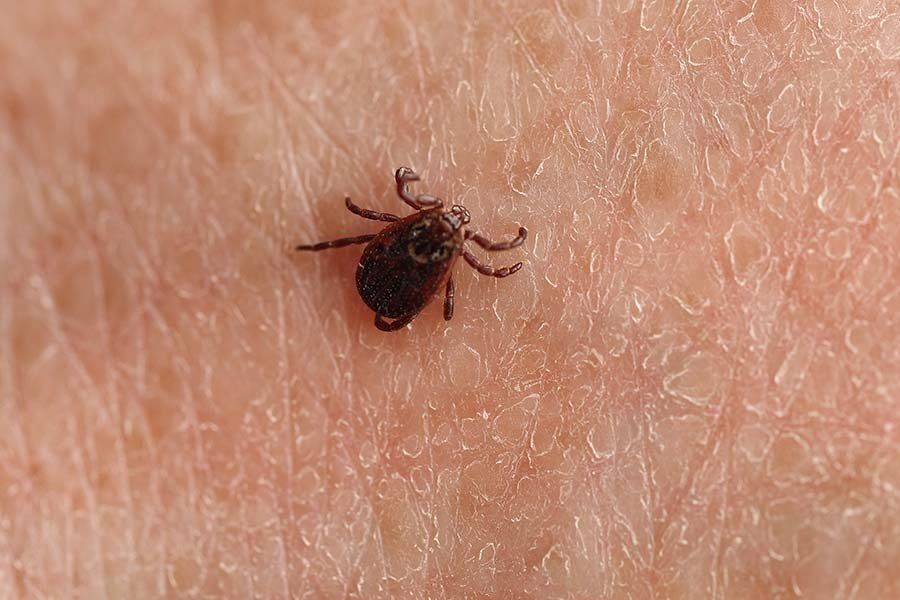 live tick on the human body close-up