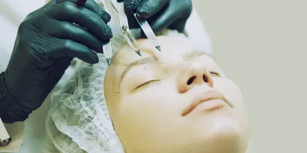 Eyebrow Transplant