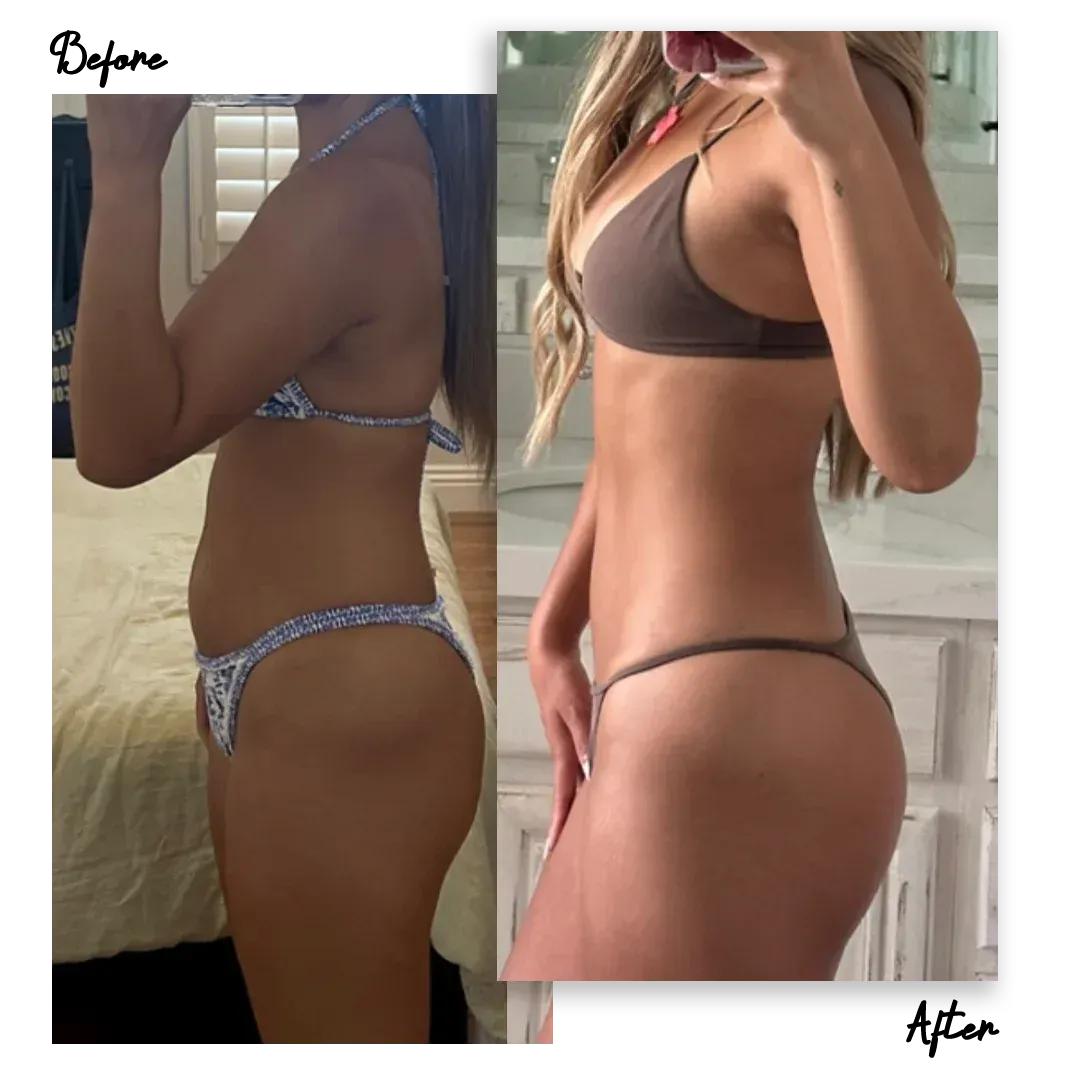 Member transformation