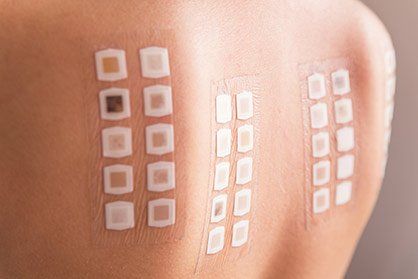 Patch Testing — Shelby Township, MI — Dermatology Specialists of Shelby Township