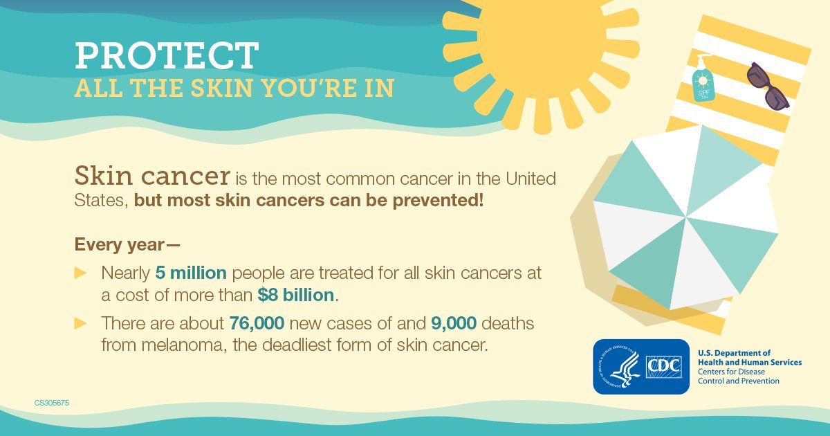 Skin Cancer Infographics — Shelby Township, MI — Dermatology Specialists of Shelby Township