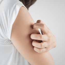 Skin Allergies — Shelby Township, MI — Dermatology Specialists of Shelby Township