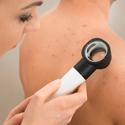 Skin Cancer — Shelby Township, MI — Dermatology Specialists of Shelby Township