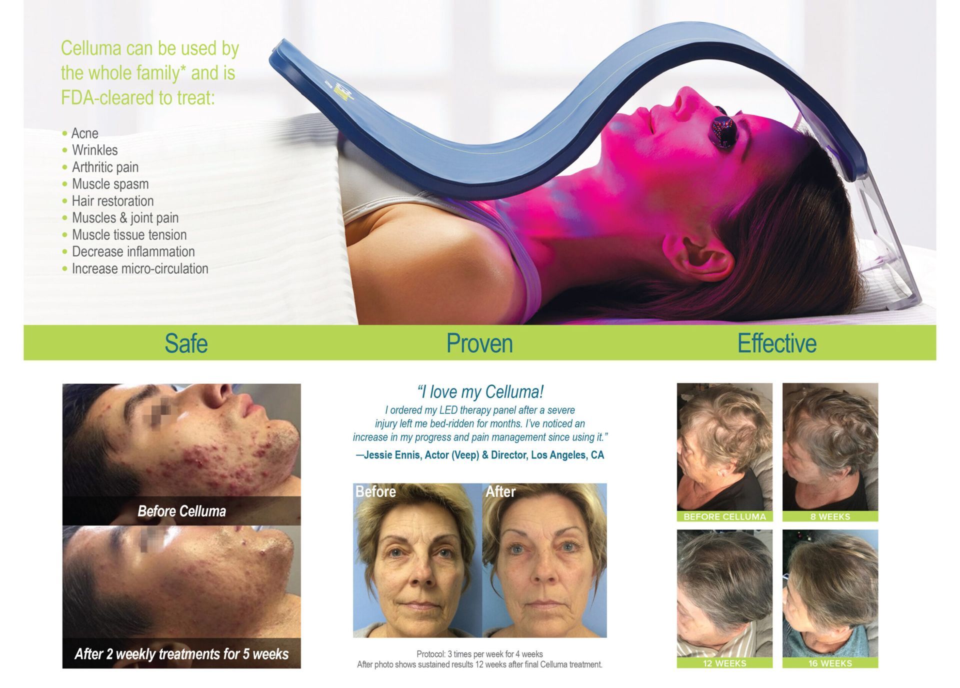 A woman under a blue light therapy device. Shown before and after results for acne, skin aging, and hair growth.