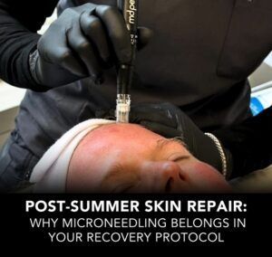 Person receiving microneedling treatment on the face. Gloved hands holding device. Text: 