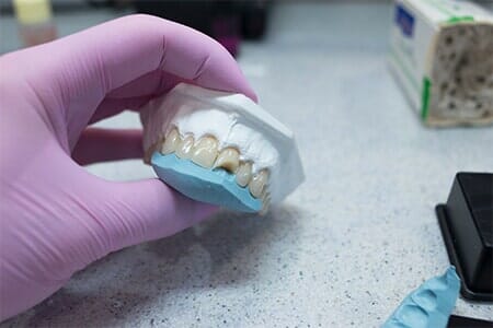 Dental Bridges — Dentistry in Newport News, VA