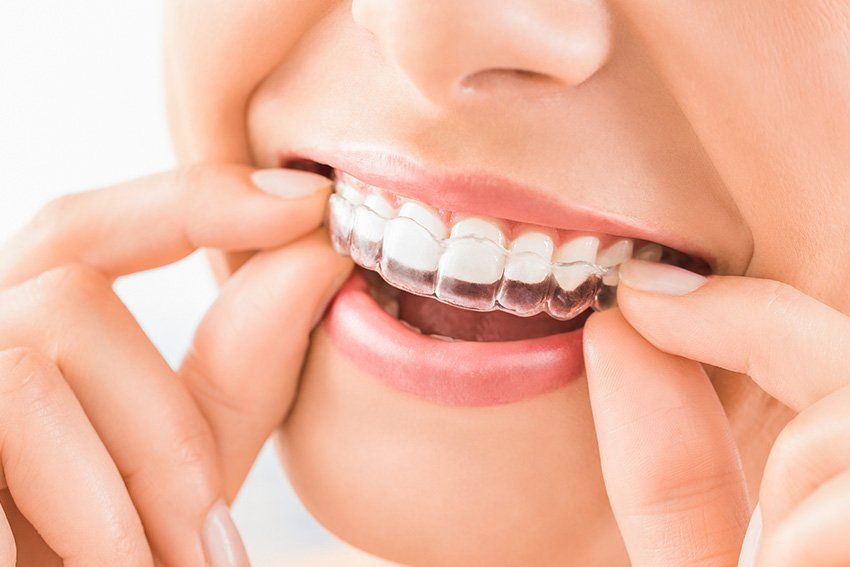 Close up of woman putting on Invisalign braces