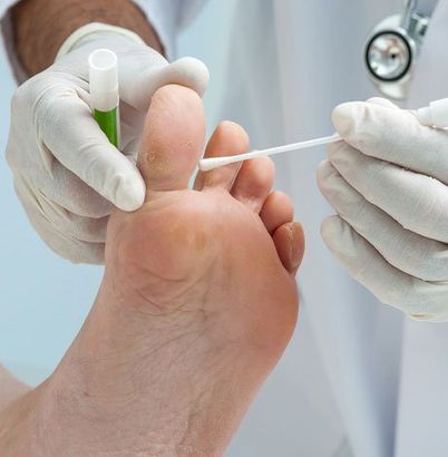 Doctor dermatologist examines the foot on the presence of athletes foot