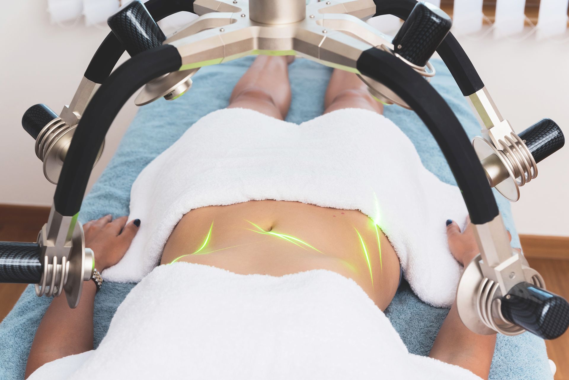 Person lying on a table, receiving a body contouring treatment. Green laser beams are directed at the abdomen.