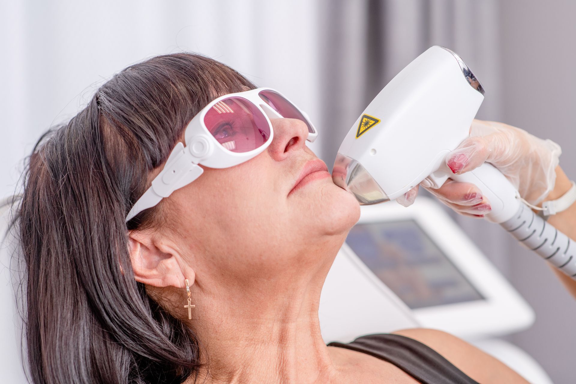 Woman receiving laser hair removal treatment on her chin, wearing protective eyewear, indoors.