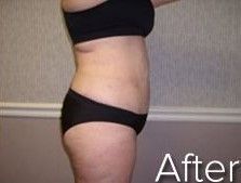 Side view of a person wearing black underwear and a sports bra.