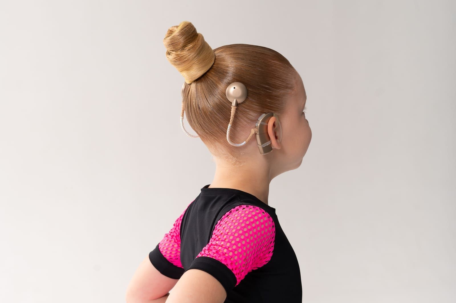 child-with-cochlear-implant-hearing-aid
