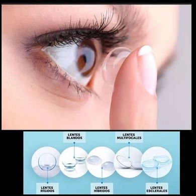 Primer plano de una lente de contacto que se coloca en un ojo