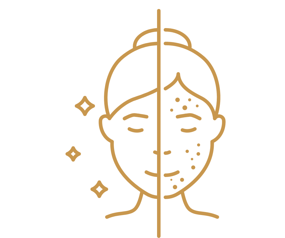 huidproblemen, acné, eczeem, rosacea, psoriasis