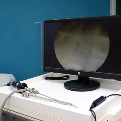 Image d’une cystoscopie urinaire.