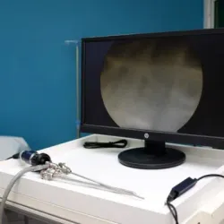 Image d’une cystoscopie urinaire.