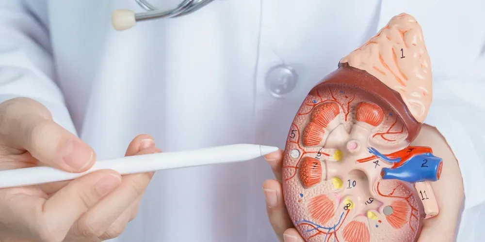 Images de calculs rénaux dans les uretères