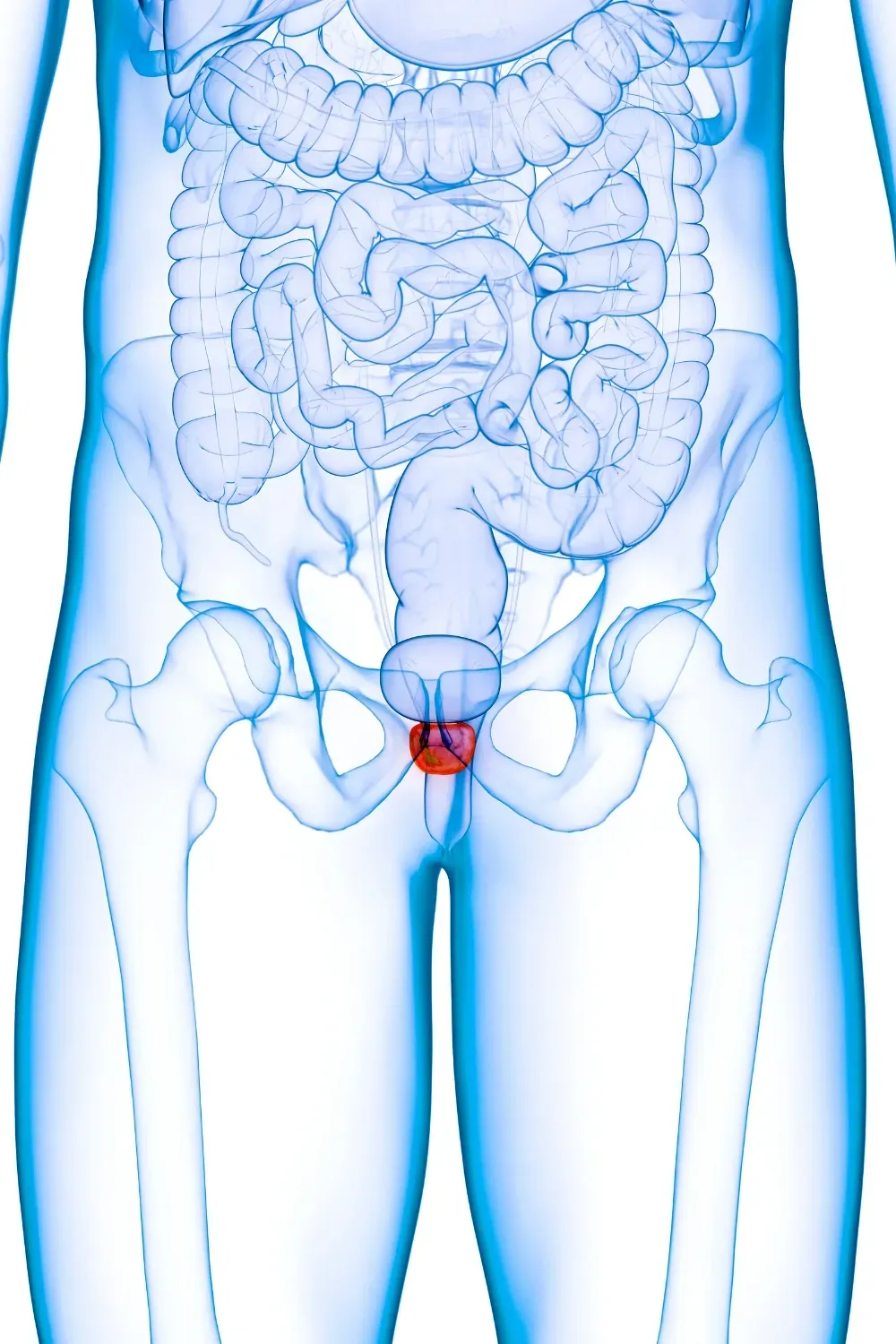 Illustration du cancer de la prostate