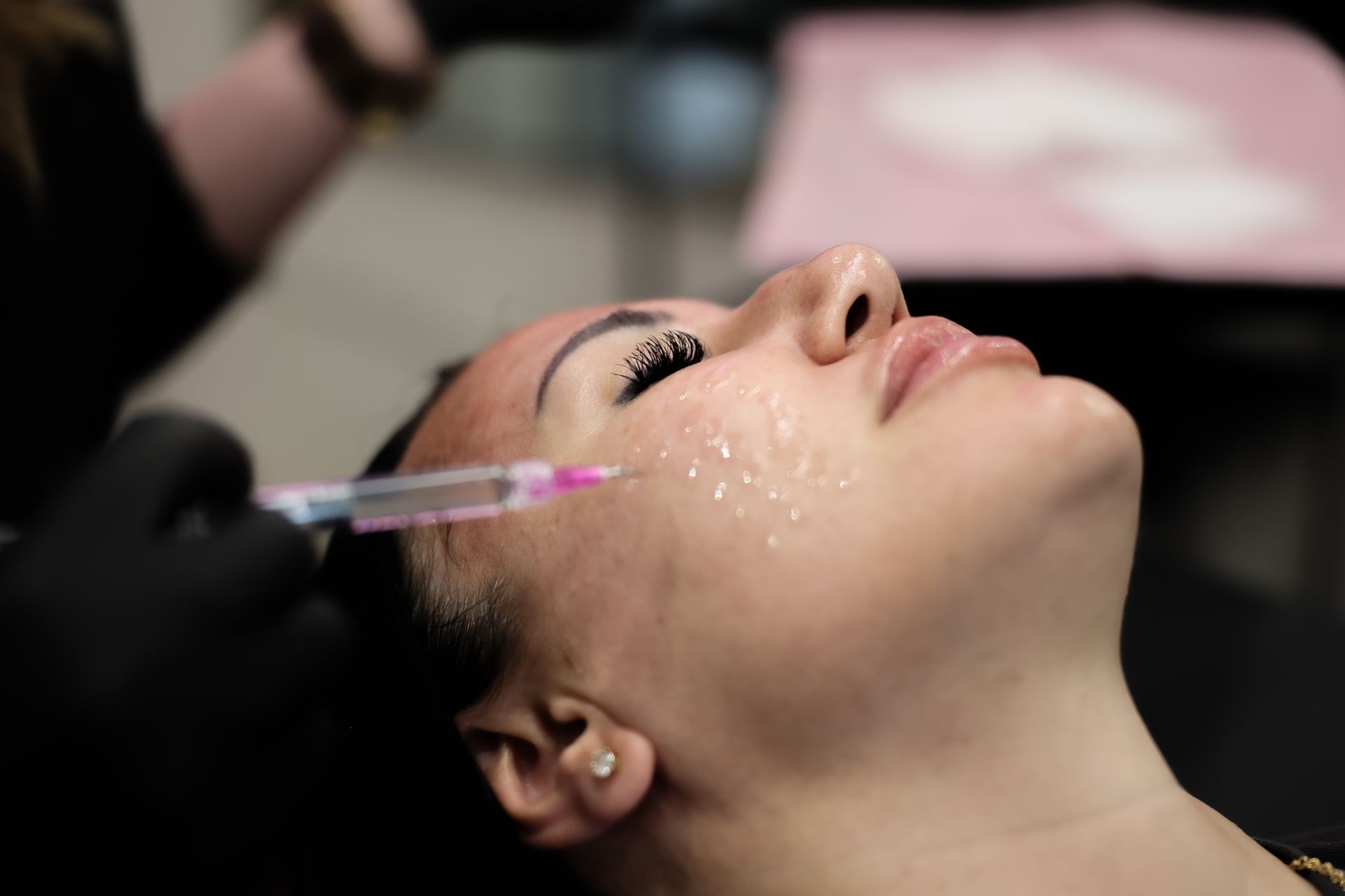 Medical provider performing microneedling on a client to smooth fine lines, refine texture, and prom