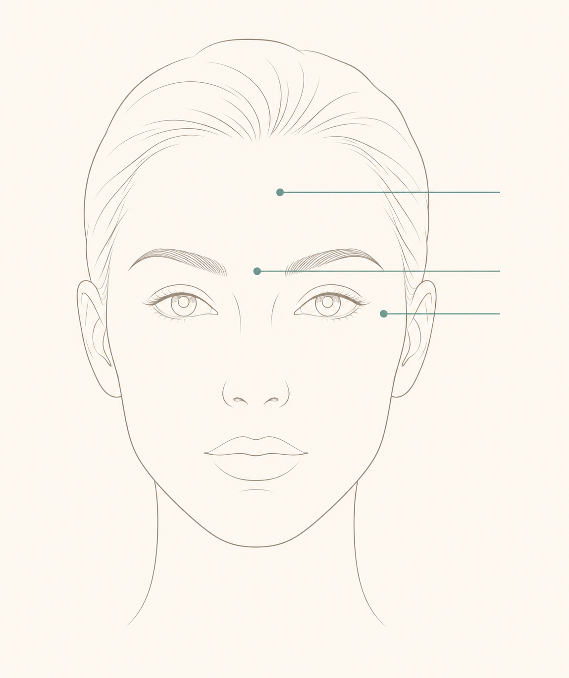 Graphics showing botox placement