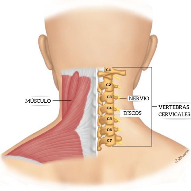 Cómo aliviar el dolor de las lesiones en el cuello