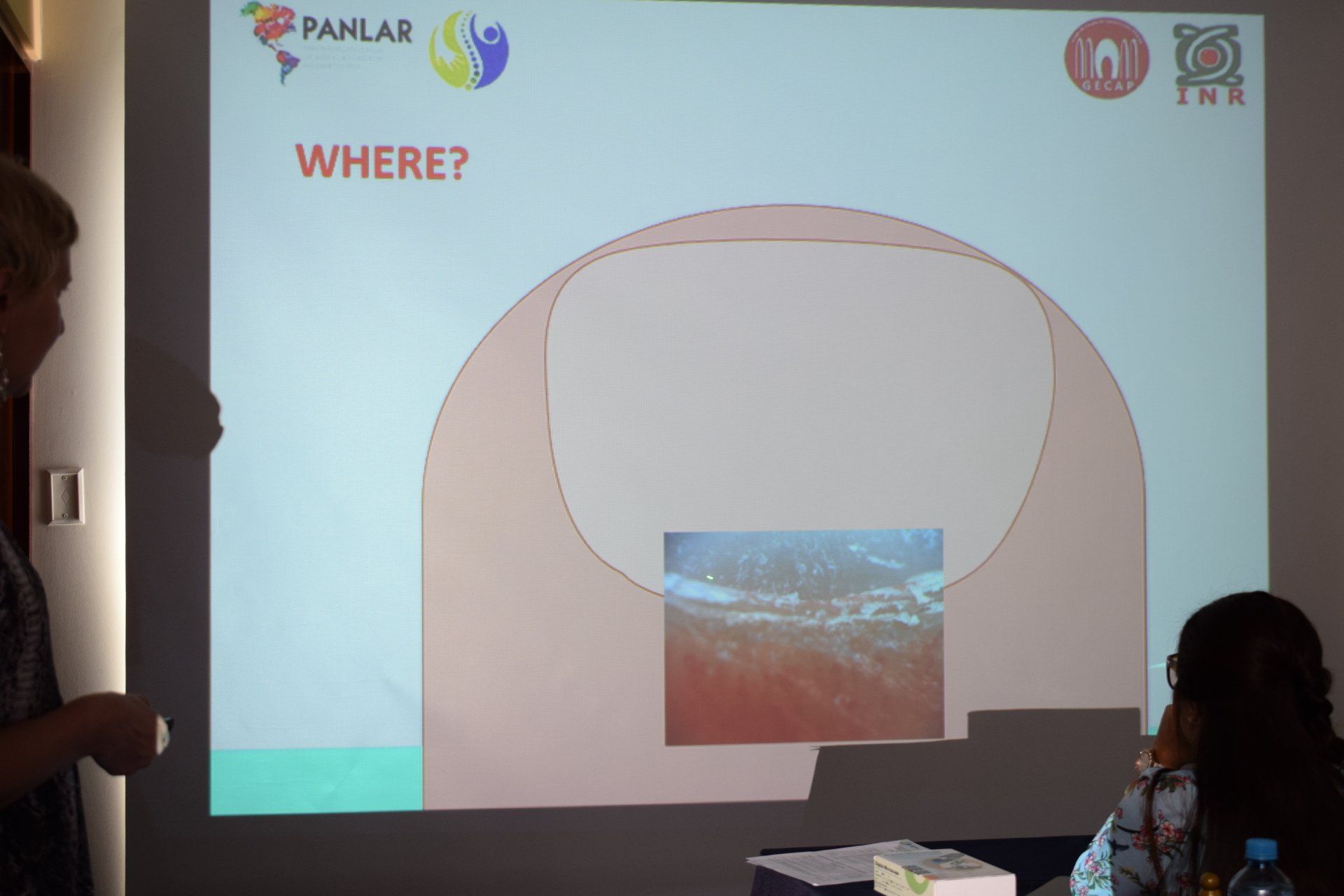 Una pantalla de proyección muestra una imagen de un dedo y la pregunta dónde