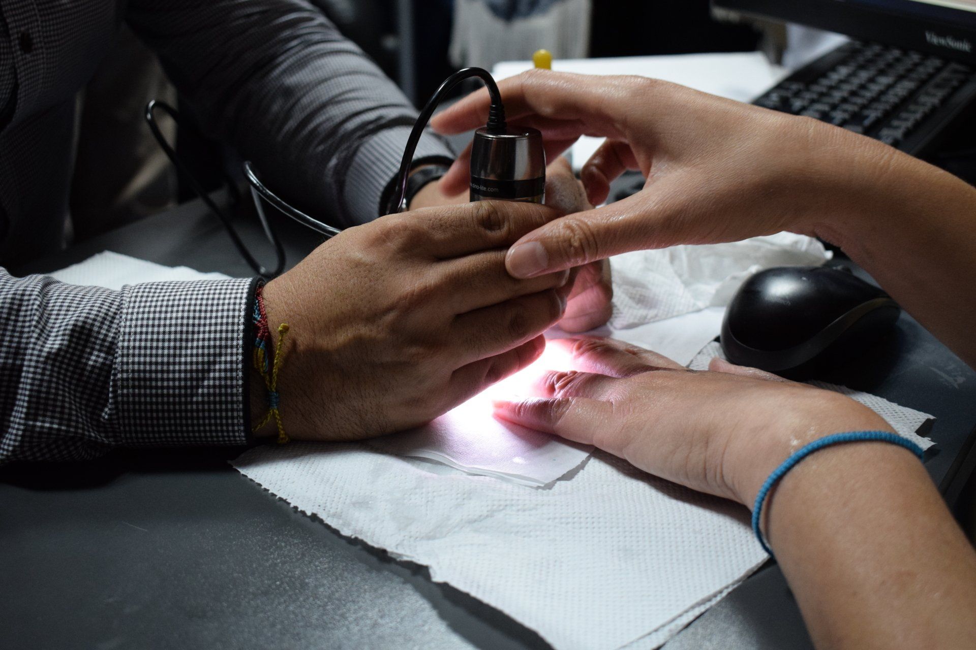 Una persona está examinando la mano de otra persona con un microscopio.