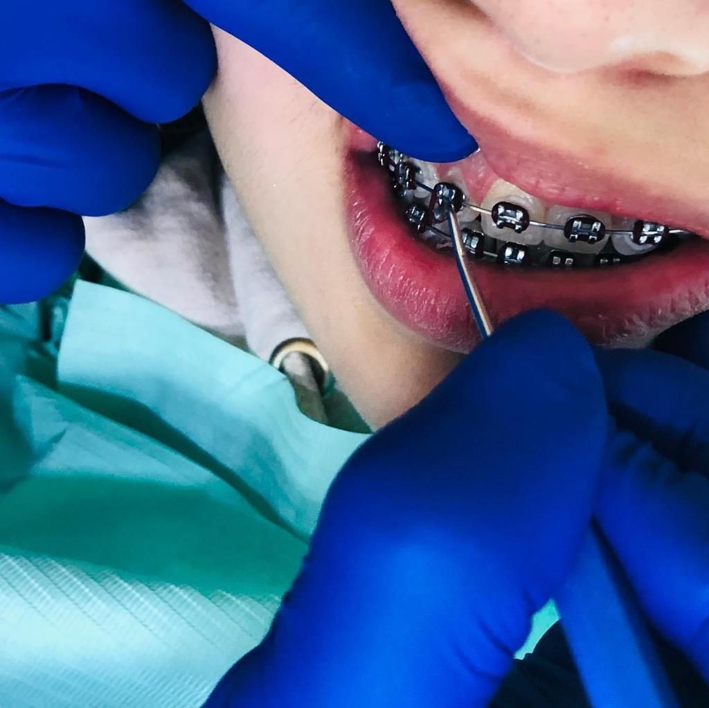 Una persona con brackets se hace examinar los dientes por un dentista.
