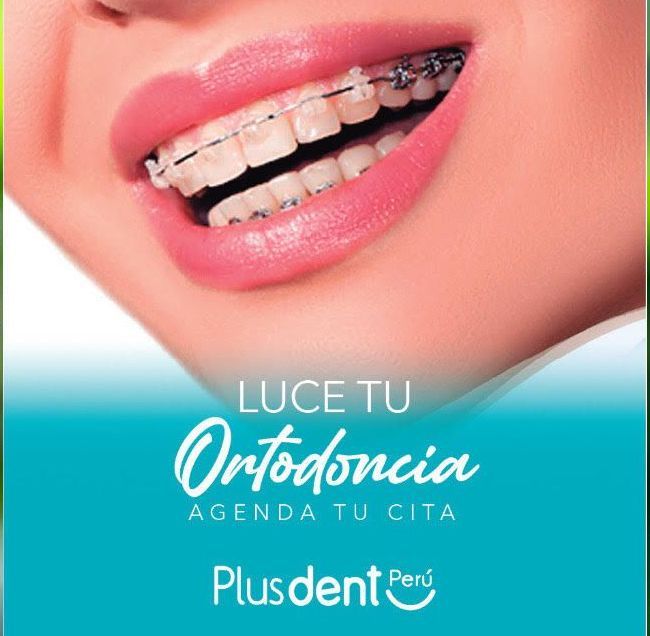 Una mujer con aparatos dentales está sonriendo