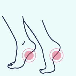 A diagram of two feet standing on their toes with red circles highlighting points of potential pain.