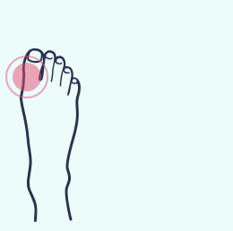 A drawing of a foot with a pink spot on it.