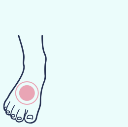 A diagram of one foot with a red circle highlighting a point of potential pain on the top of the foot behind the toes.