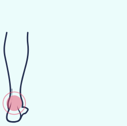 A drawing of a person 's foot with a red spot on it.