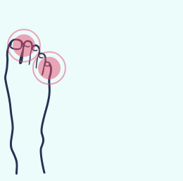 A drawing of a person 's foot with a pink circle around the toes.