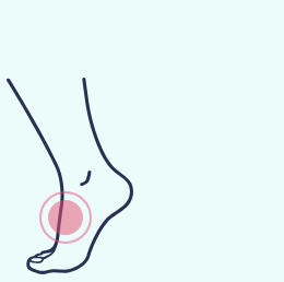 A diagram of one foot standing on it's toes with a red circle highlighting a point of potential pain.