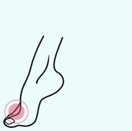 A drawing of a foot with a pink circle around it.