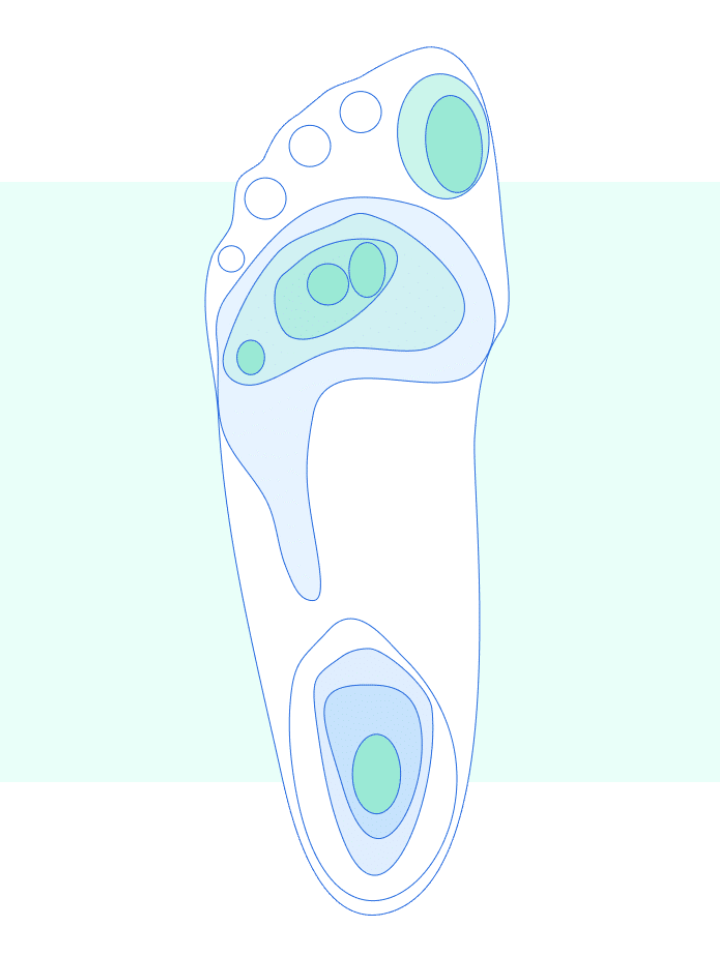A drawing of a foot with blue circles on it