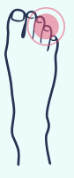 A drawing of a foot with a pink circle around it.