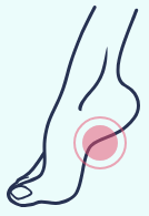 A drawing of a foot with a pink circle around it.