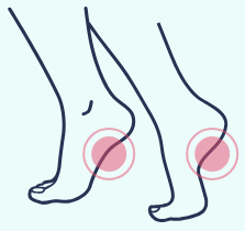 A drawing of a person 's feet with pink circles on them.