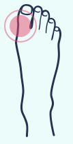 A drawing of a foot with a pink circle around the toe.