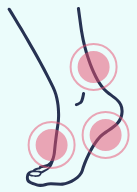 A drawing of a foot with pink circles around it.