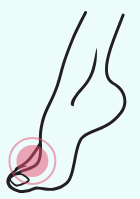 A drawing of a foot with a pink circle around it.